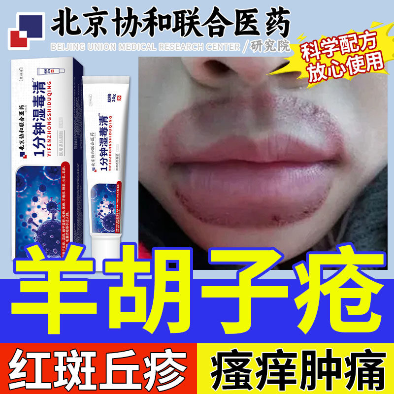 羊胡子疮泡疹口周唇炎小孩舔嘴唇干裂起泡瘙痒红肿脱皮丘疹瘙痒yr