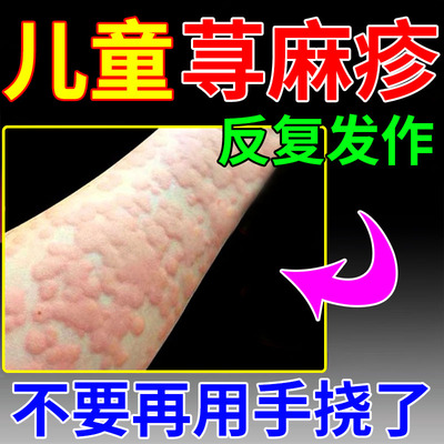 【儿童荨麻疹】风团红斑瘙痒