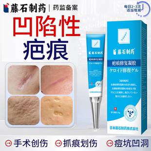凹陷性疤痕指甲抓伤生长因子痘坑凹洞水痘凹陷遮神器去疤修复膏JW