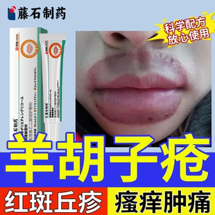 羊胡子疮泡疹口周唇炎小孩舔嘴唇干裂起泡瘙痒红肿脱皮丘疹瘙痒DZ