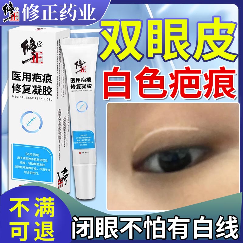 【修正】双眼皮白色疤痕