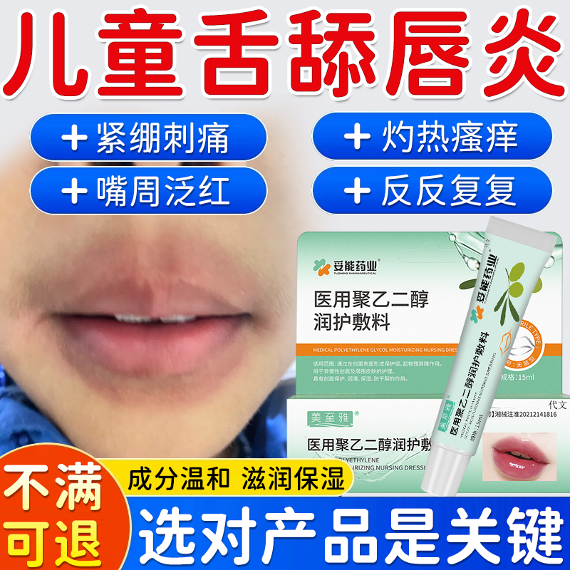 儿童舔嘴唇嘴巴一圈唇炎专用唇膏