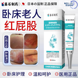 卧床老人红屁股藤石制薬护臀膏尿布疹皮炎成人褥疮特祛腐效生肌EM