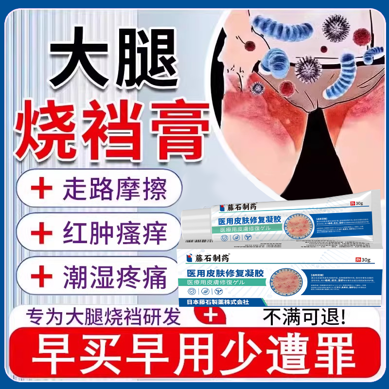 【大腿烧裆】摩擦潮湿反复瘙痒膏