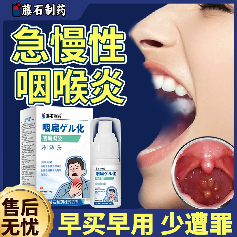 会厌囊肿咽喉炎异物感有痰声带小结息肉 滤泡增生搭喷雾剂去除EM