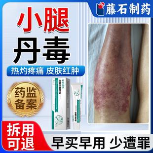 藤石制药丹毒专软膏用修复下肢小腿红斑皮肤疼痛热灼消肿炎喷剂EM
