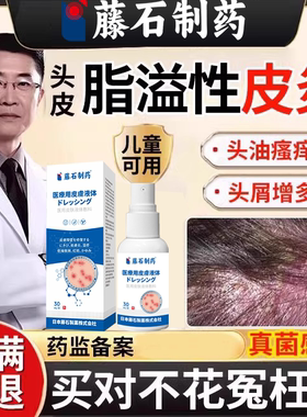 儿童脂溢性皮炎毛囊炎头皮屑消真菌感染杀菌头癣头部炎喷剂喷雾DZ