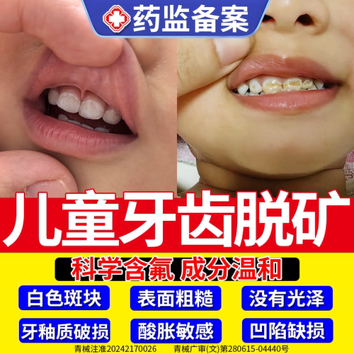 【医用级】儿童牙齿脱矿再矿化膏