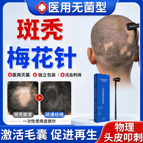 斑秃鬼剃头脱发梅花针