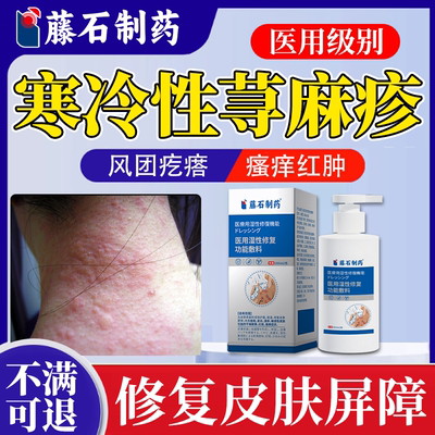 寒冷性荨麻疹过敏止痒断专用沐浴露皂着增强免疫力根药房同款膏Y8