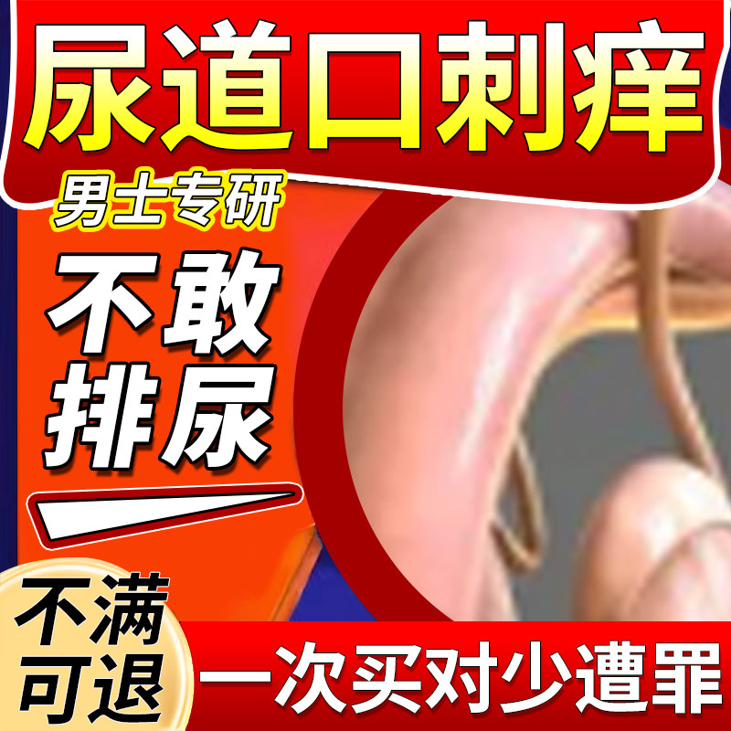 男性尿道口刺痒痛流脓尿道炎尿路感染专用红肿淋病特性病效克星ro
