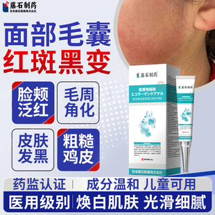 面部毛囊红斑黑变病儿童脸颊两边小疙瘩毛周角化症药房同售膏DS