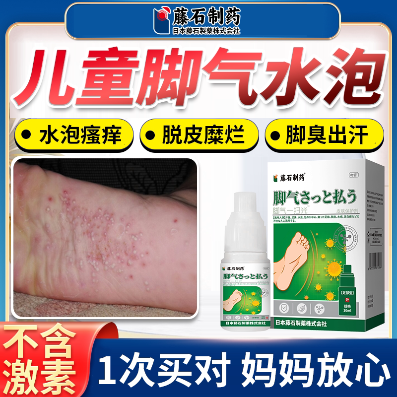 儿童水疱型脚气止痒脱皮杀菌小孩水泡烂脚丫臭脚出汗去脚痒膏根ys