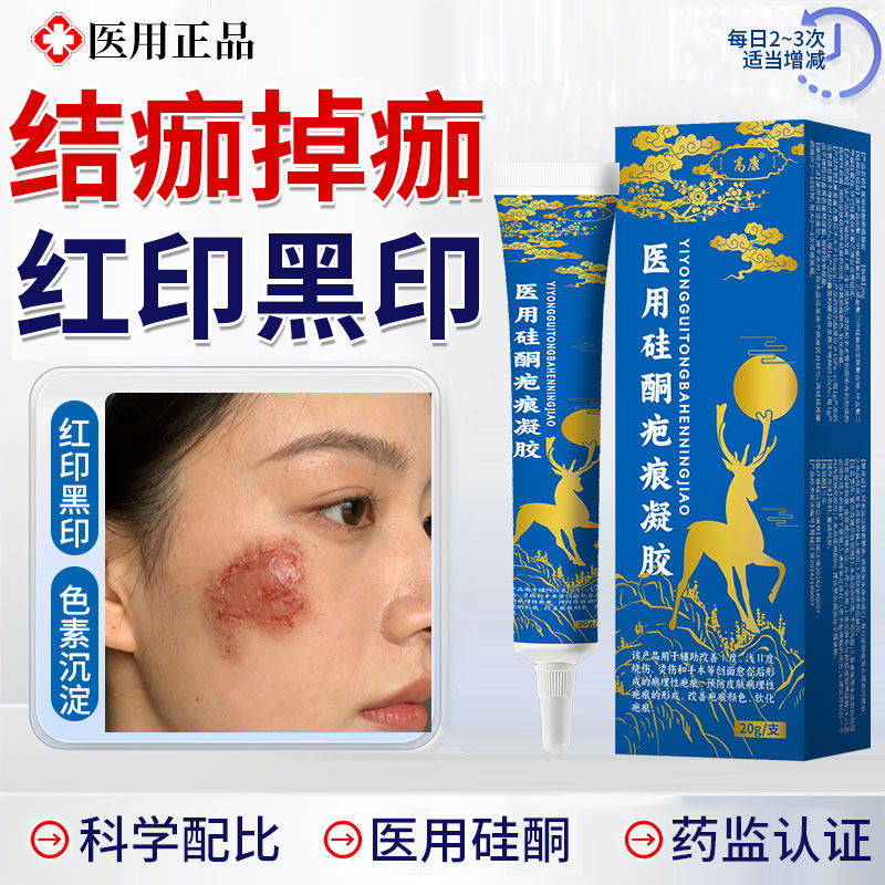 高康硅酮疤痕凝胶掉痂后去红印图片