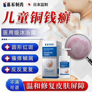 儿童铜钱癣体癣沐浴露专用膏皮肤止痒抑菌瘙痒真菌感染药房同款YY