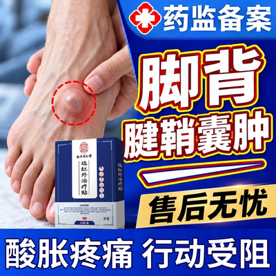 脚背腱鞘囊肿鼓包消除专用贴