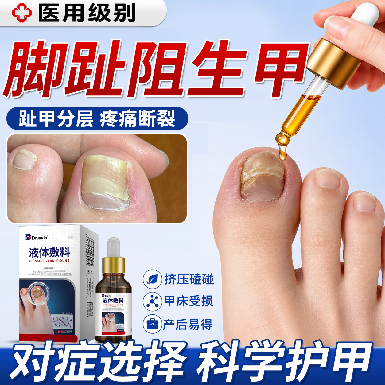 大脚趾阻生甲专用修复液--医用级图片