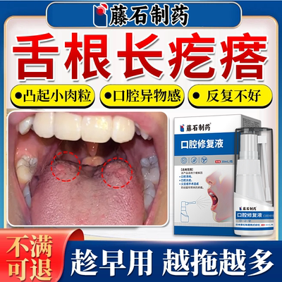 【舌根长疙瘩】凸起小肉粒异物感