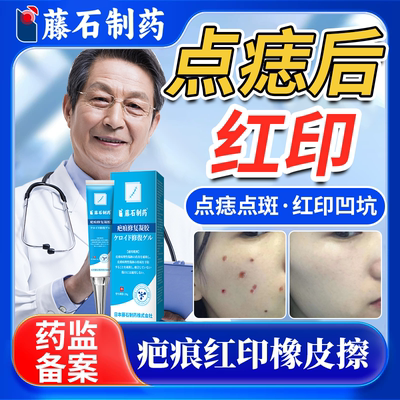 日本公司监制】去点痣后疤痕红印