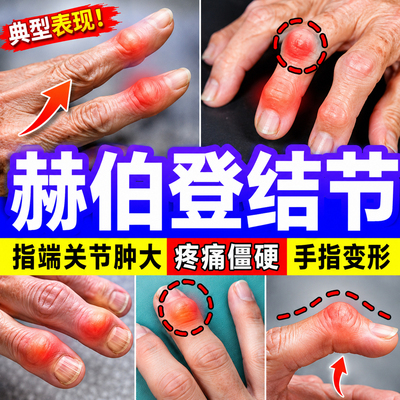 赫伯登结节手指变形肿大疼痛僵硬