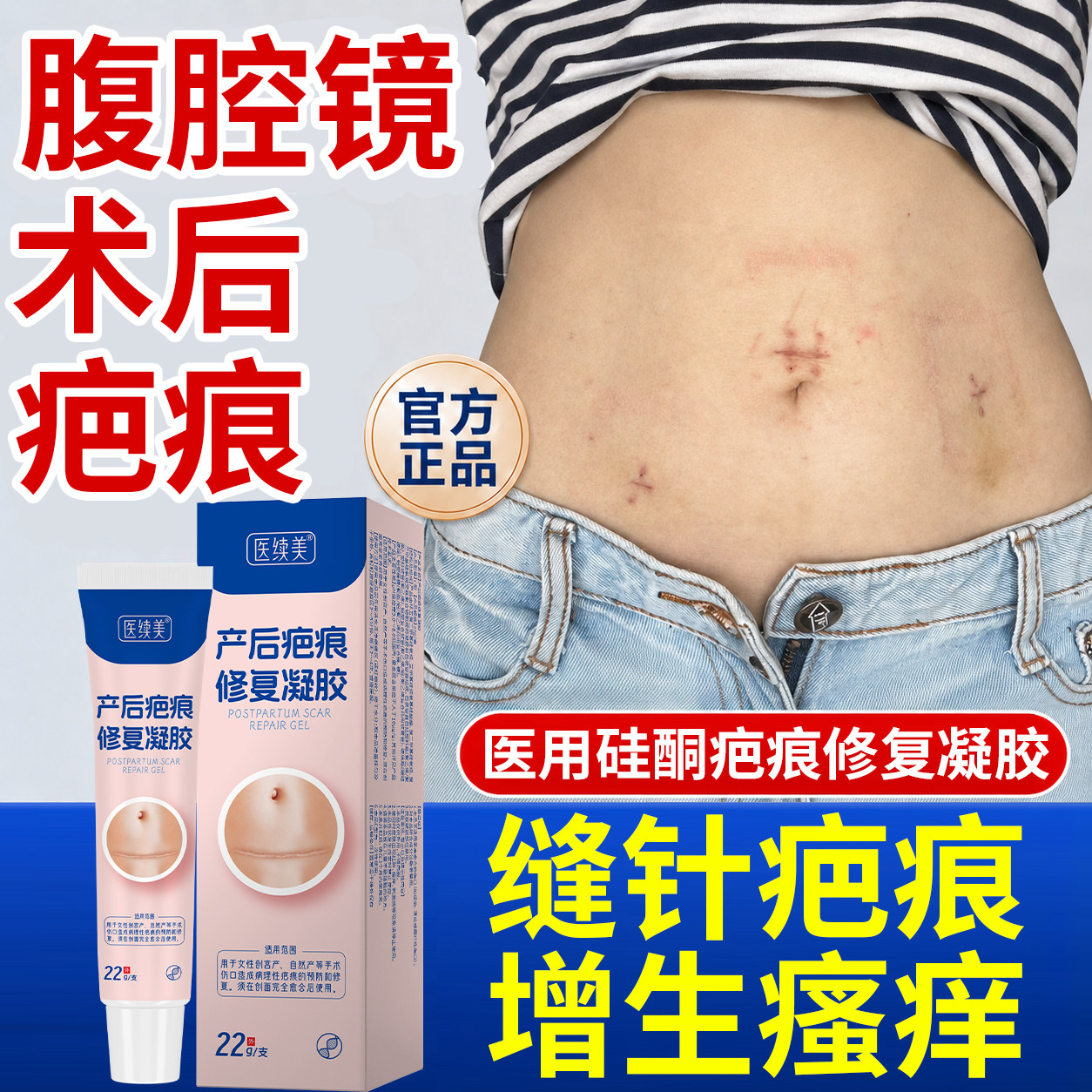 腹腔镜术后祛疤膏手术缝针疤痕修复去疤增生凸起医用硅酮凝胶DS