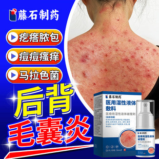 背后长痘痘前胸后背毛囊炎除螨祛痘背发红瘙痒上止痒沐浴露喷雾TU