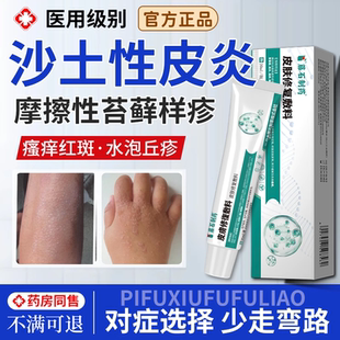沙土性皮炎特异接触性乳膏皮癣过敏湿疹湿痒止痒水疱疹药房同款YY