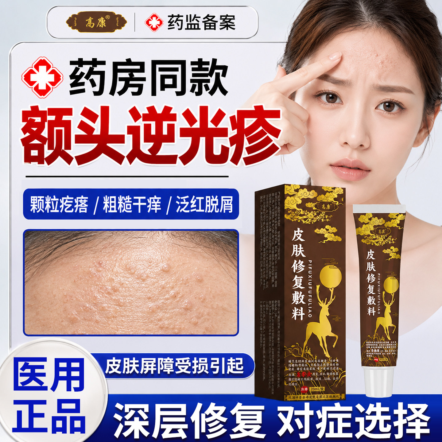 逆光疹修复脸上起小疙瘩额头痘痘闭口粉刺的克星去除脸部脂肪粒YZ