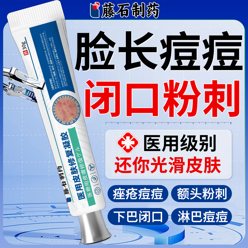 额头脸上起小疙瘩去除脸部痘痘痤疮祛闭口粉刺的克星药房同售膏VQ