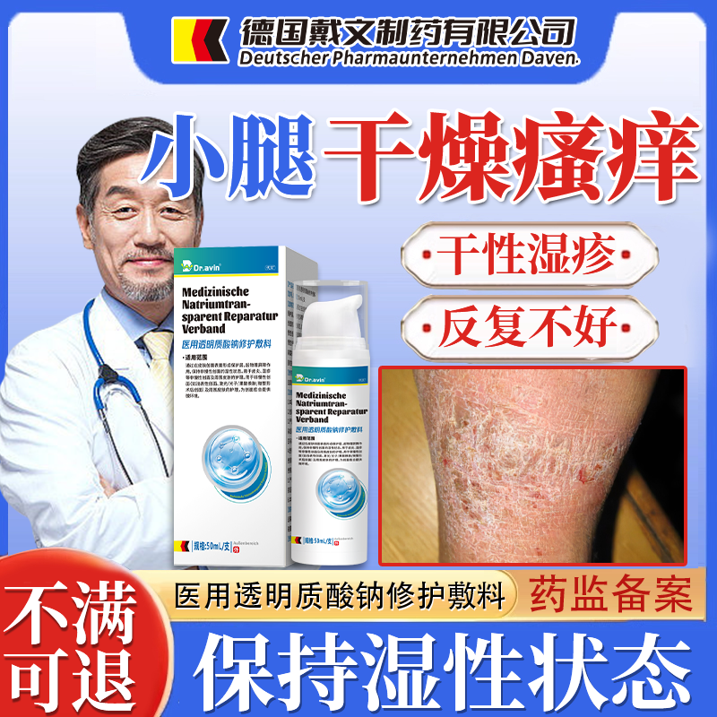 小腿干燥瘙痒皮肤痒儿童干性湿疹专用止痒皮炎敷料药房同款膏CF