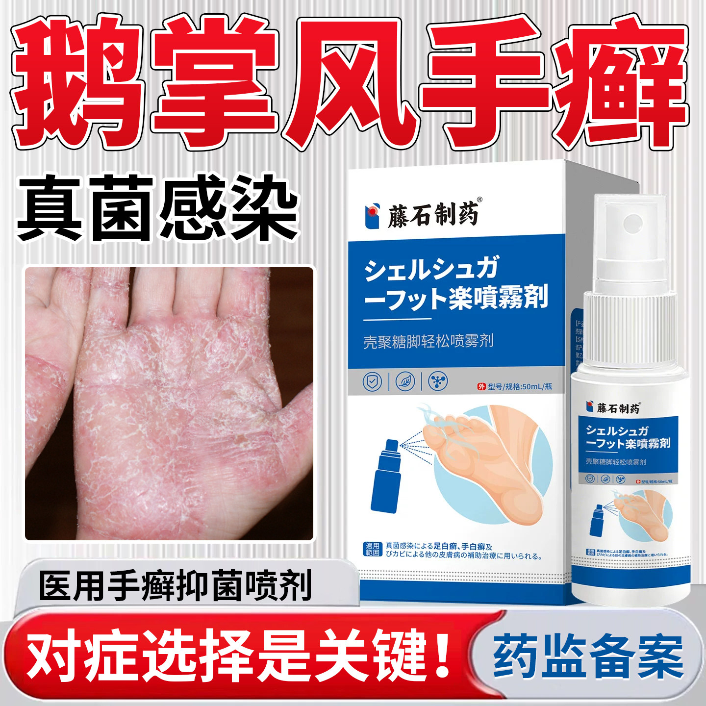 鹅掌风专用可搭治疗手癣藓手掌干裂脱皮开裂真菌感染膏药房同售DS