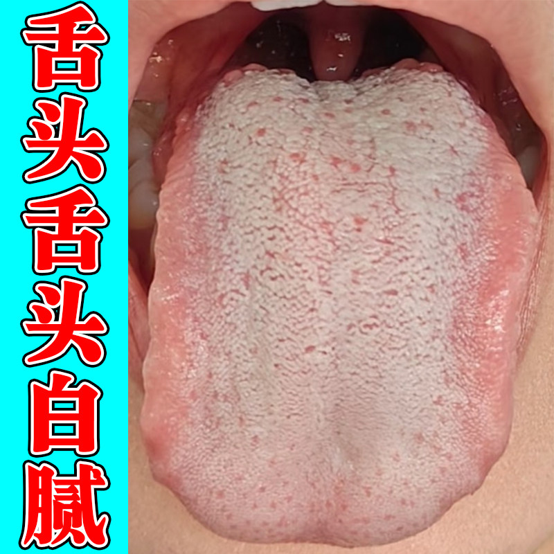 舌头舌苔发白厚腻舌裂纹有齿痕肚子胀气积食口腔儿童口腔有异味臭