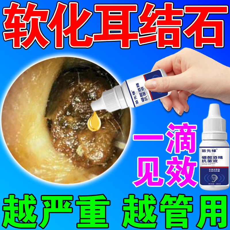 耳结石软化水耳屎软化液取耳耵聍清理硼酸酒精冰片滴耳液药水神器