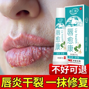 唇炎唇膏嘴巴红肿嘴唇上长疱疹干裂起皮起水泡红痒脱皮口周唇部炎