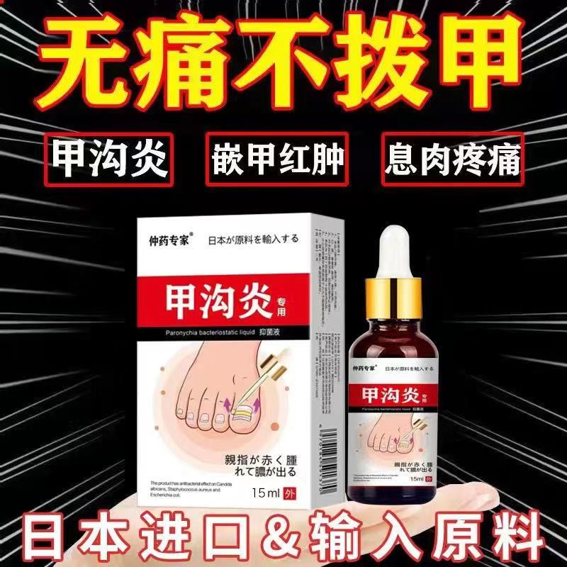 速发甲沟炎专嵌软甲消肿去肉芽修复疼用甲沟红肿液痛消肉芽化脓液