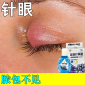 眼上长脓包红肿热痛针眼发痒眼睑板腺堵塞儿童去浮肿滴眼液