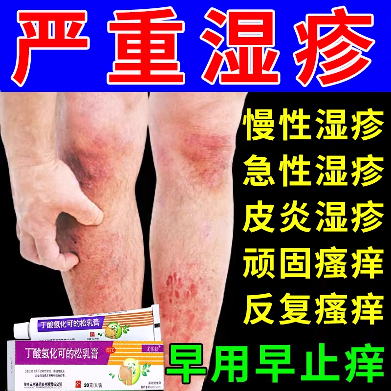 【尤伯松】丁酸氢化可的松乳膏20g*1支/盒