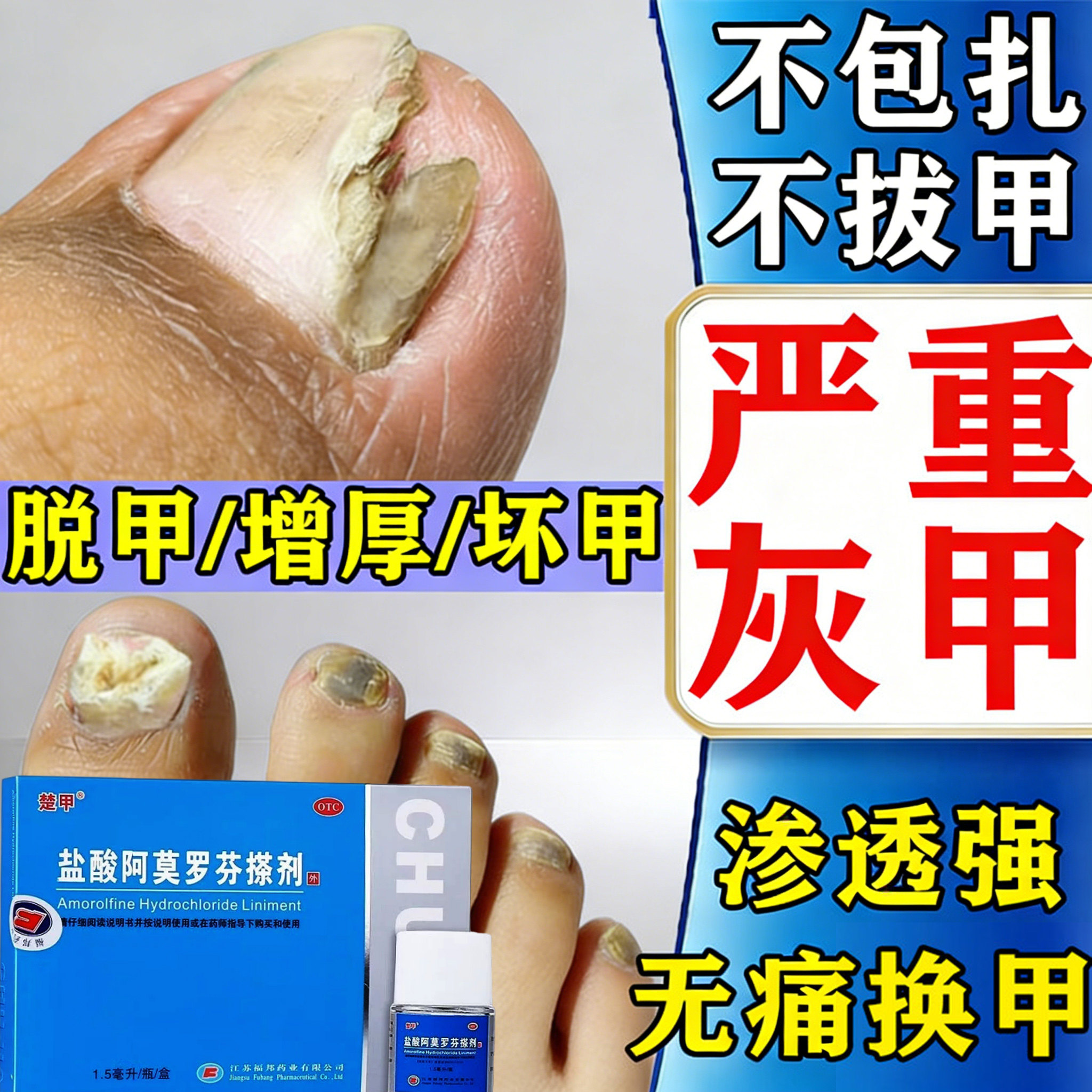 楚甲盐酸阿莫罗芬搽剂灰指甲环吡酮胺真菌感染专用正品官方旗舰店