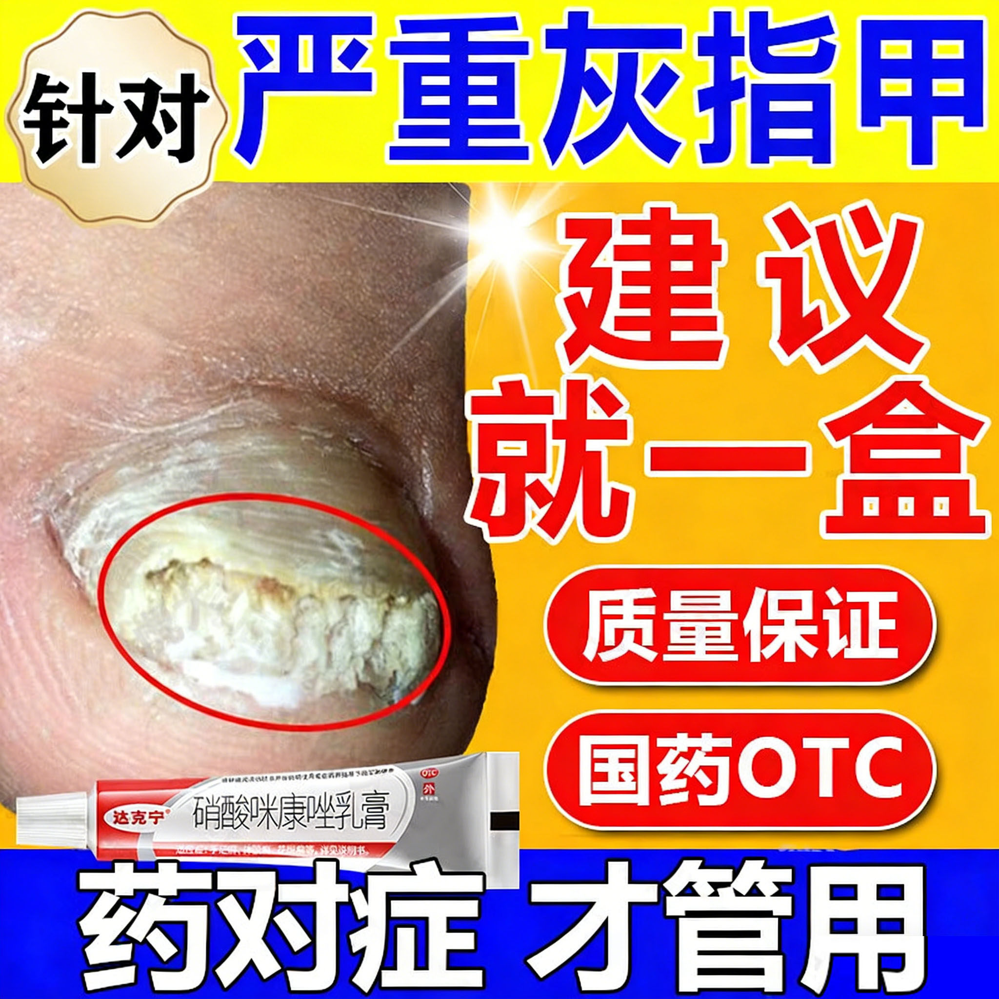 [达克宁]硝酸咪康唑乳膏2%*20g*1支/盒图片