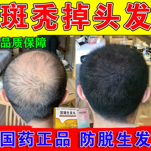【俊宏】固肾生发丸0.139g*36丸*4板/盒