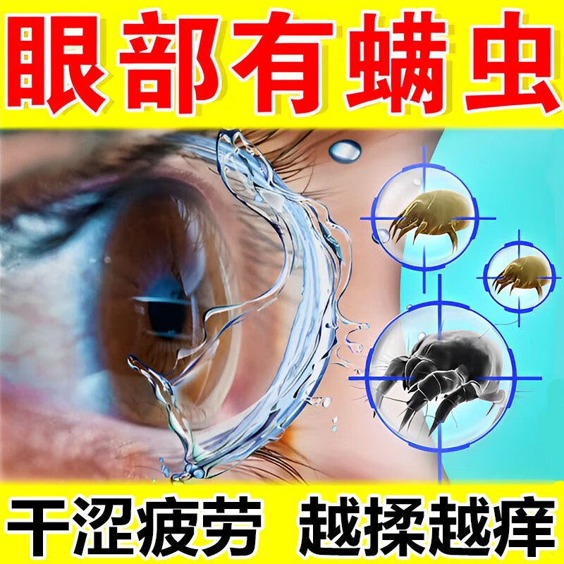 眼睛除螨虫药 治疗眼部螨虫发炎有异物感视觉疲劳眼干眼涩瘙痒