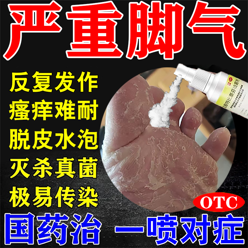 达克宁盐酸特比萘芬喷雾脚气药根止痒真菌感染水泡治烂脚丫专用药