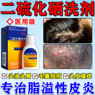 二硫化硒洗发水脂溢性皮炎专用药洗剂头皮屑官方旗舰店严重去头屑