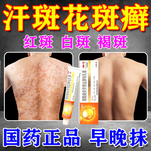 治疗汗斑花斑专用药膏成人皮肤瘙痒真菌感染手癣体癣斑点糠疹药膏