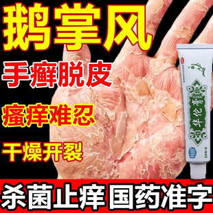 华佗膏治疗鹅掌风专用药手癣膏脱皮干裂真菌感染手掌粗糙变厚药膏