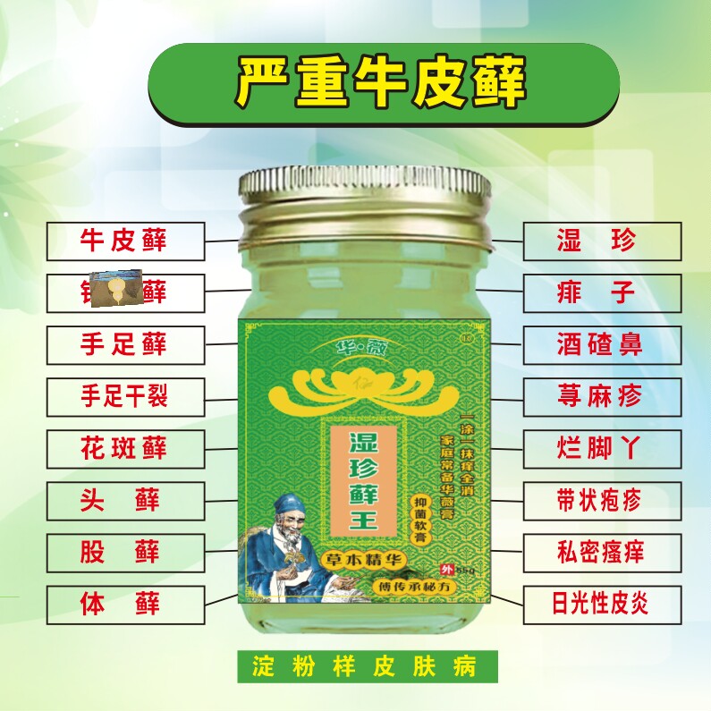 湿珍藓王牛皮抑菌软膏藓王膏头皮屑股银皮肤杀菌症止痒王专用