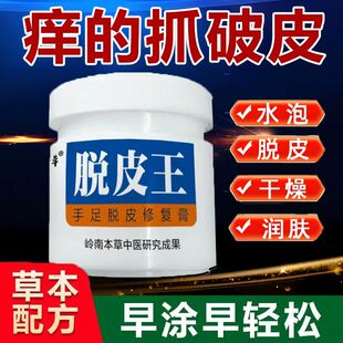 手足脱皮膏手掌脱皮痒开裂干燥脚后跟干裂手指脱皮水泡手痒止痒膏