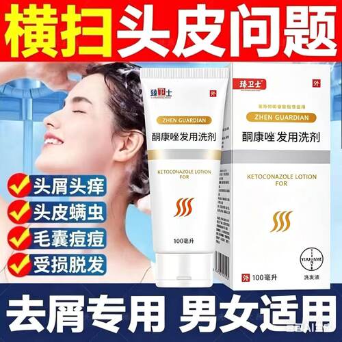 【药店同款】酮康强效去屑痒洗发水清洁去头皮经典老牌子洗发露