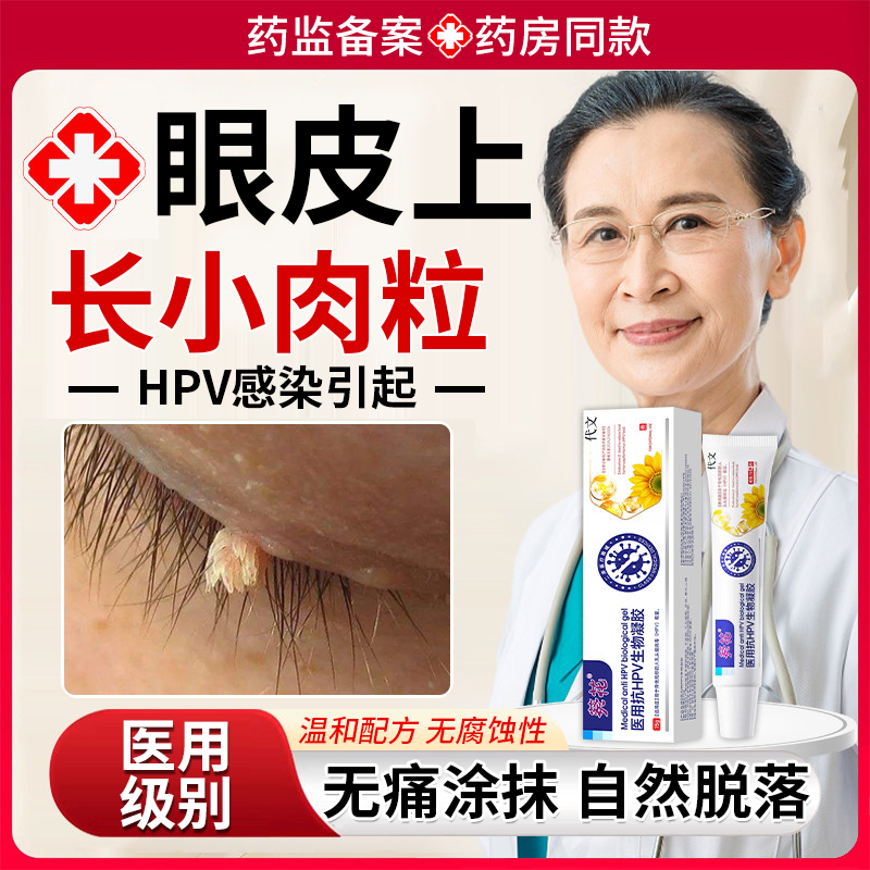 眼皮上长小肉粒丝状疣疙瘩去除神器专用祛疣瘊扁平疣药房同款膏EM,医疗器械,保健理疗,淘宝优惠券,粉丝福利购,淘宝优惠卷