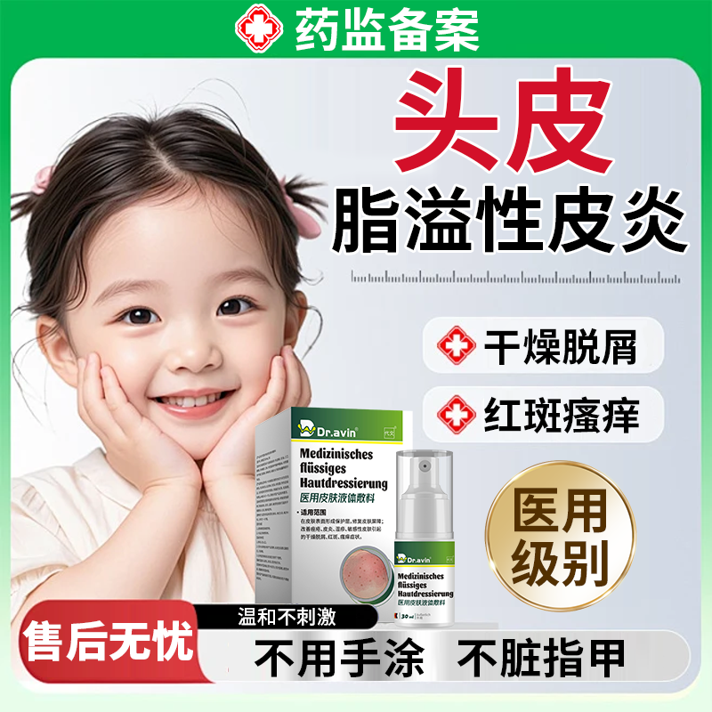 儿童头皮真菌感染溢脂脂溢性皮炎专用洗发水干燥起屑头部喷雾剂MP
